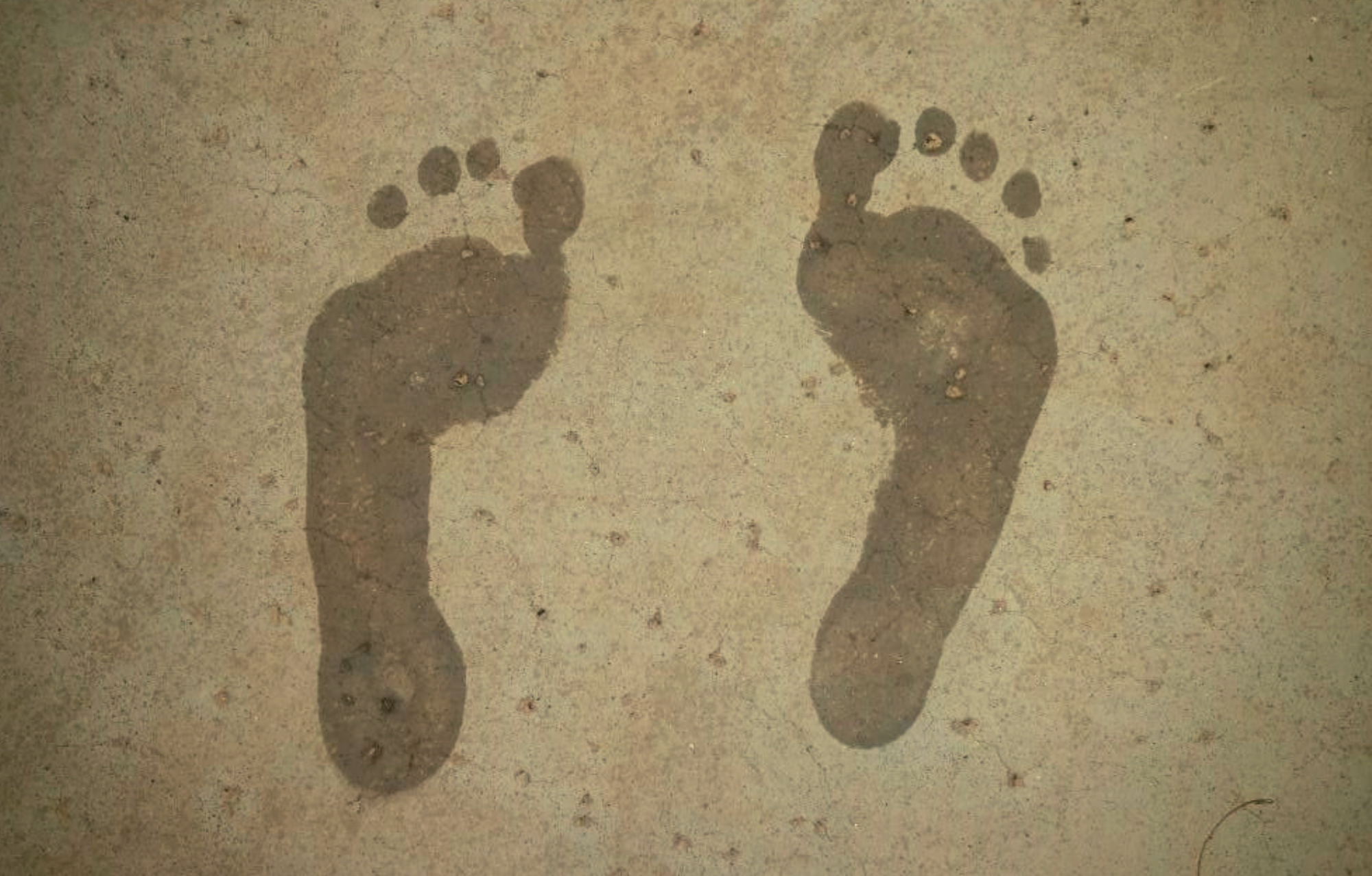 Footprints Showing High Arches Footprints Showing High Arches