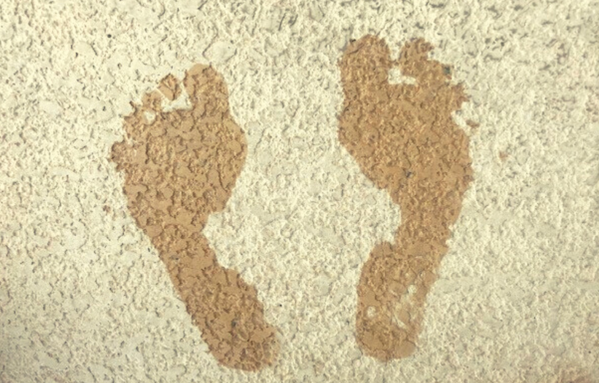 Footprints Showing Medium (Normal) Arches Footprints Showing Medium (Normal) Arches